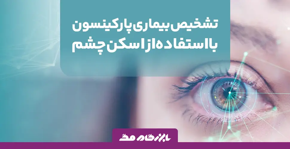 تشخیص زودهنگام بیماری پارکینسون با استفاده از اسکن چشم: یک پیشرفت علمی جدید