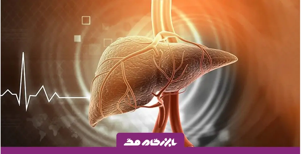 تغذیه مناسب برای کبد چرب